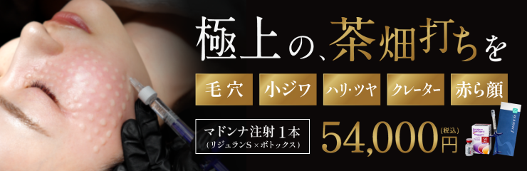 極上の、茶畑打ちを