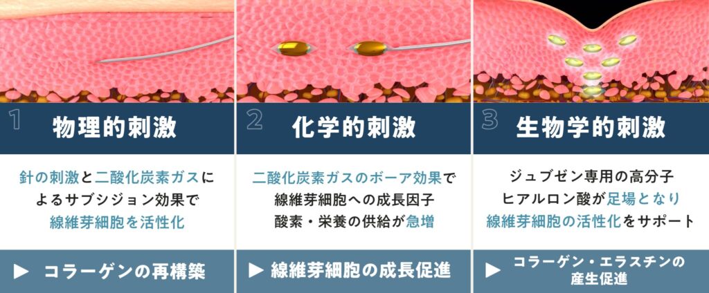 ジュブゼンのメカニズム