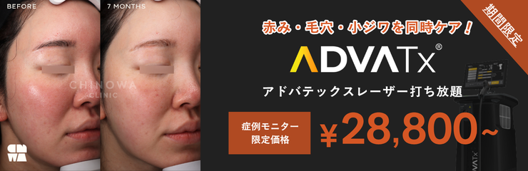 アドバキャンペーン（6-7月）