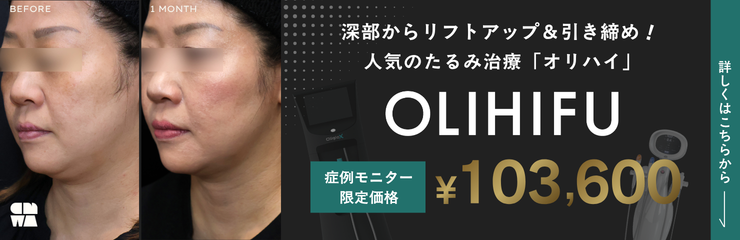 オリハイキャンペーン（7月）