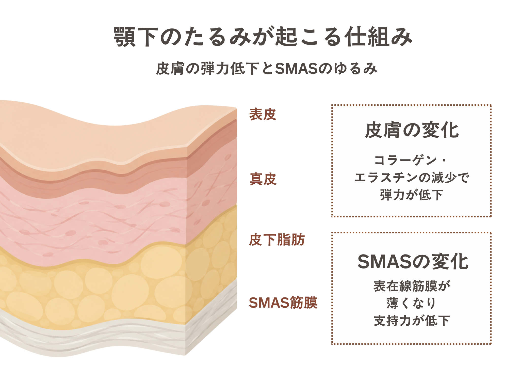 顎下のたるみが起こる仕組み（皮膚の弾力低下とSMASのゆるみ）