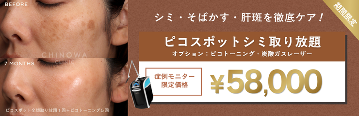 シミ治療キャンペーン